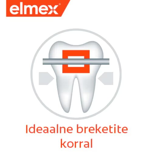 Ideaalne breketite korral
